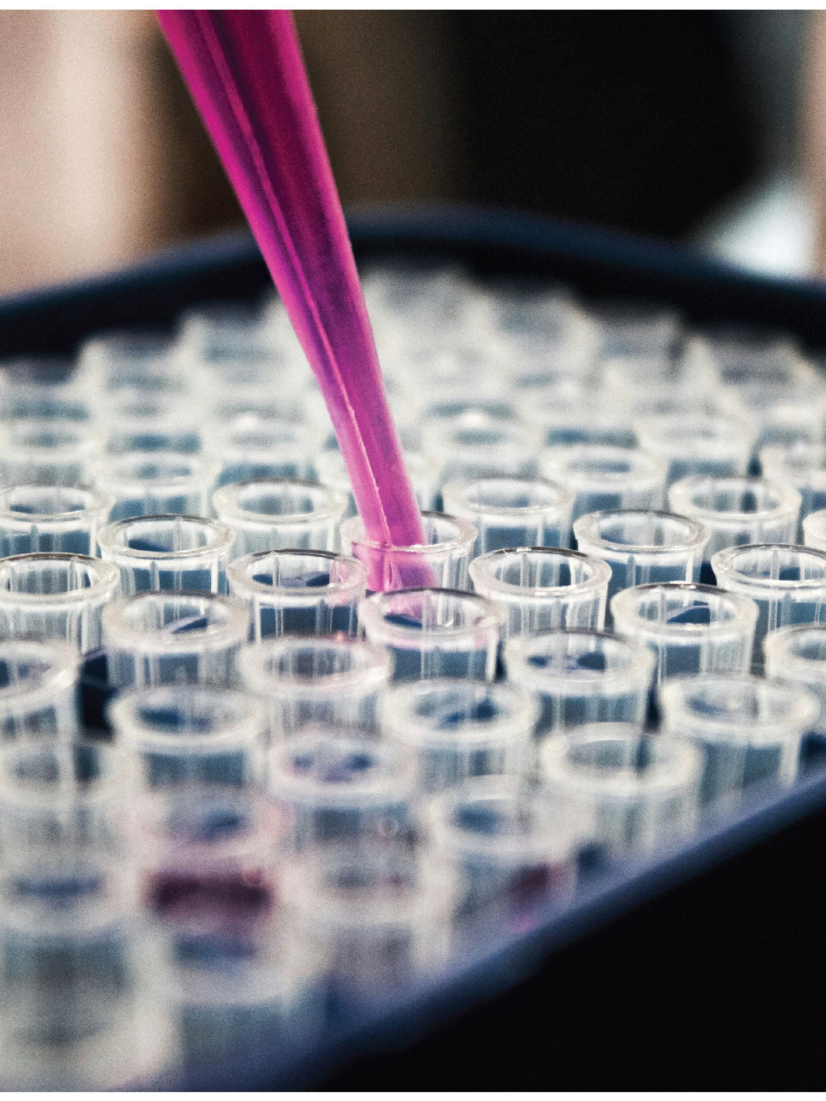 Rad MycoBlitz Pt. II: DNA Extraction and Amplification