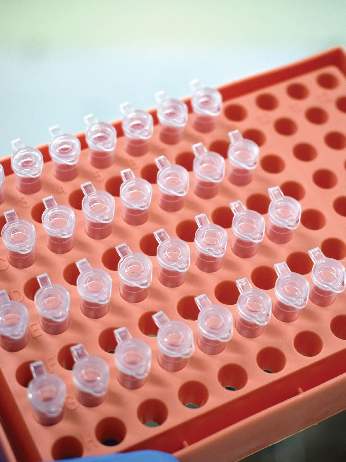 Rad MycoBlitz Pt. III: Gel Electrophoresis and Sequence Analysis